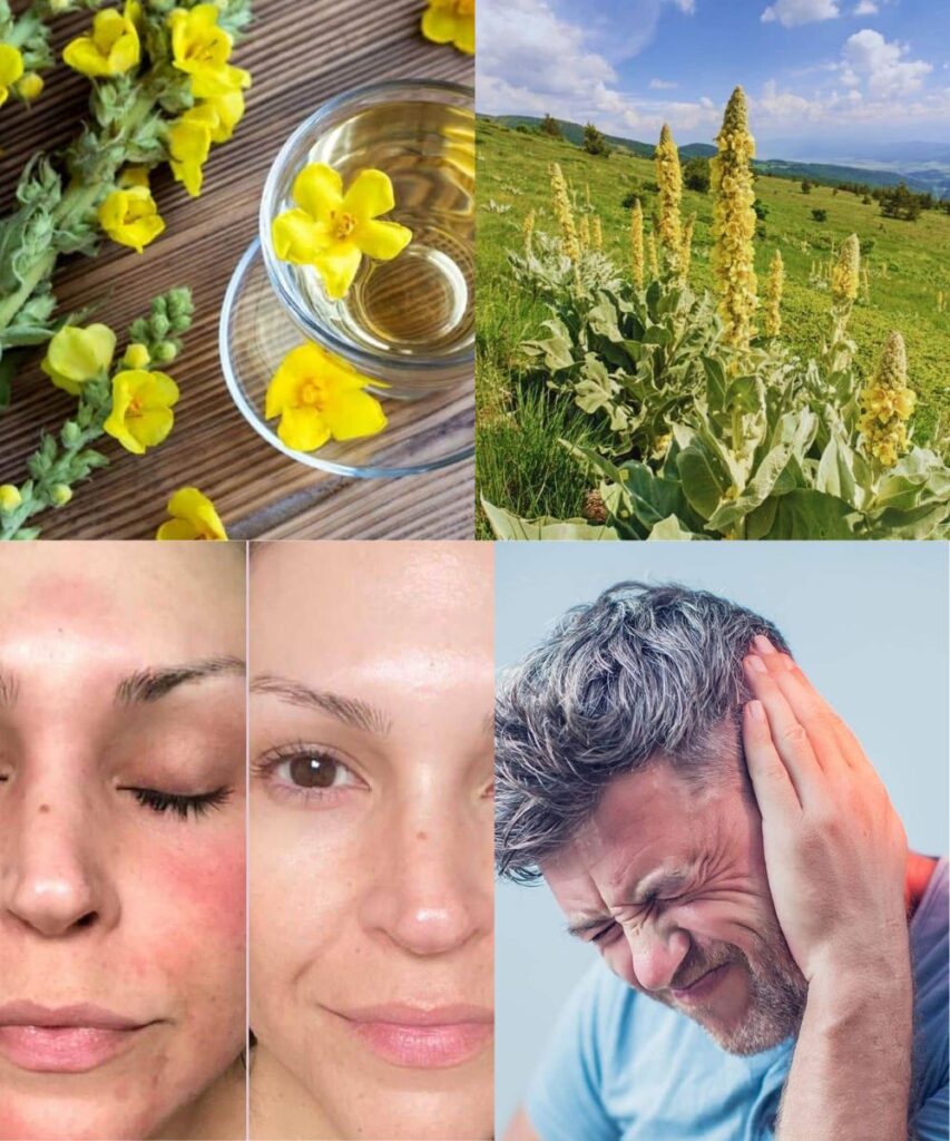 The 8 Surprising Health Benefits of Mullein You Need to Know