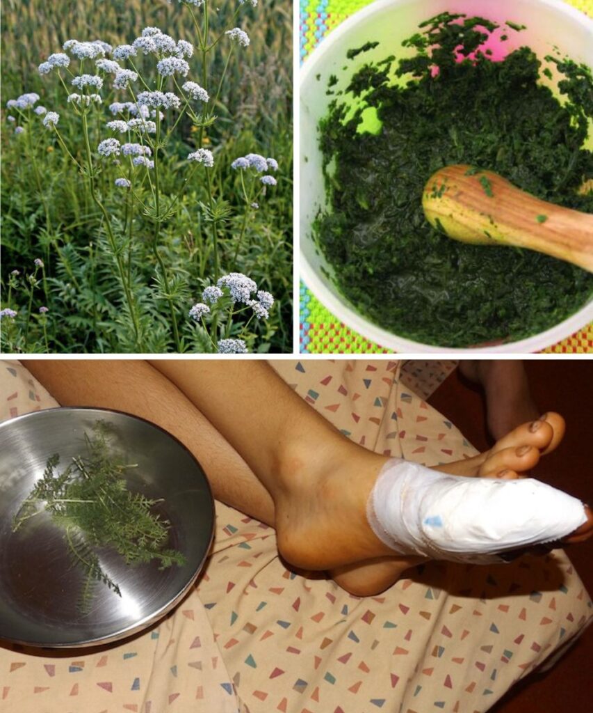 3 Steps to Use Yarrow for Stopping Bleeding Safely And Effectively