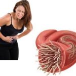 7 foods that kill worms in the intestines