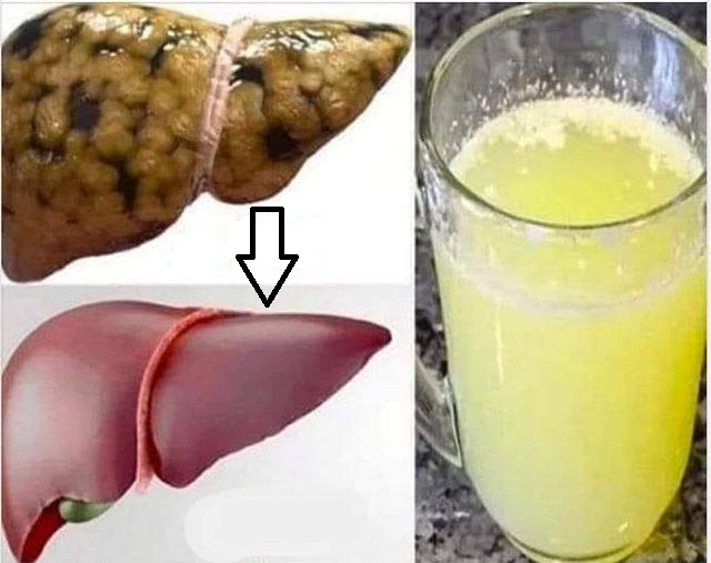 5 evening drinks that cleanse the liver and burn fat while you sleep