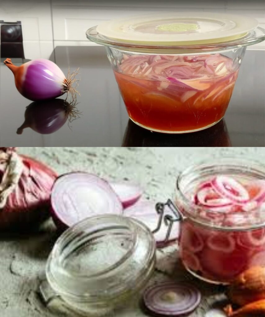 HOMEMADE COUGH SYRUP: MY MOTHER-IN-LAW’S OLD RECIPE FOR A NATURAL REMEDY FOR COUGHS, BRONCHITIS, AND PNEUMINATION