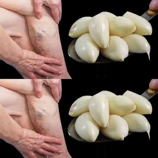 Mom’s natural remedy with garlic: An effective solution for common ailments