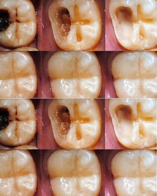 When it comes to taking care of your teeth and eating healthy