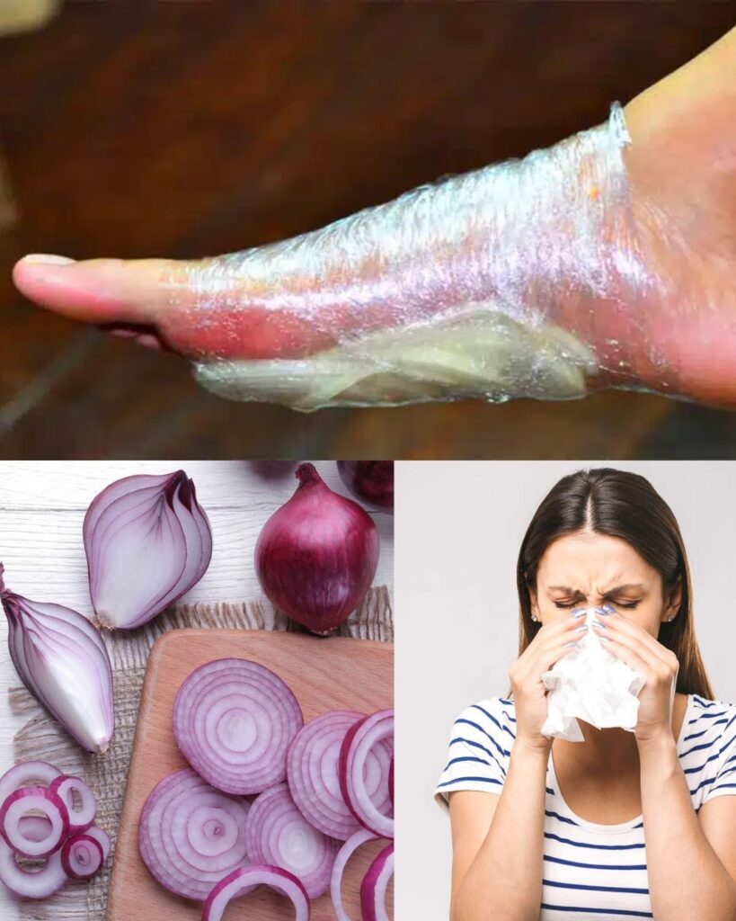 It is the old method of our grandmothers, which still works well today: make an “onion compress” and the illness is finally over!