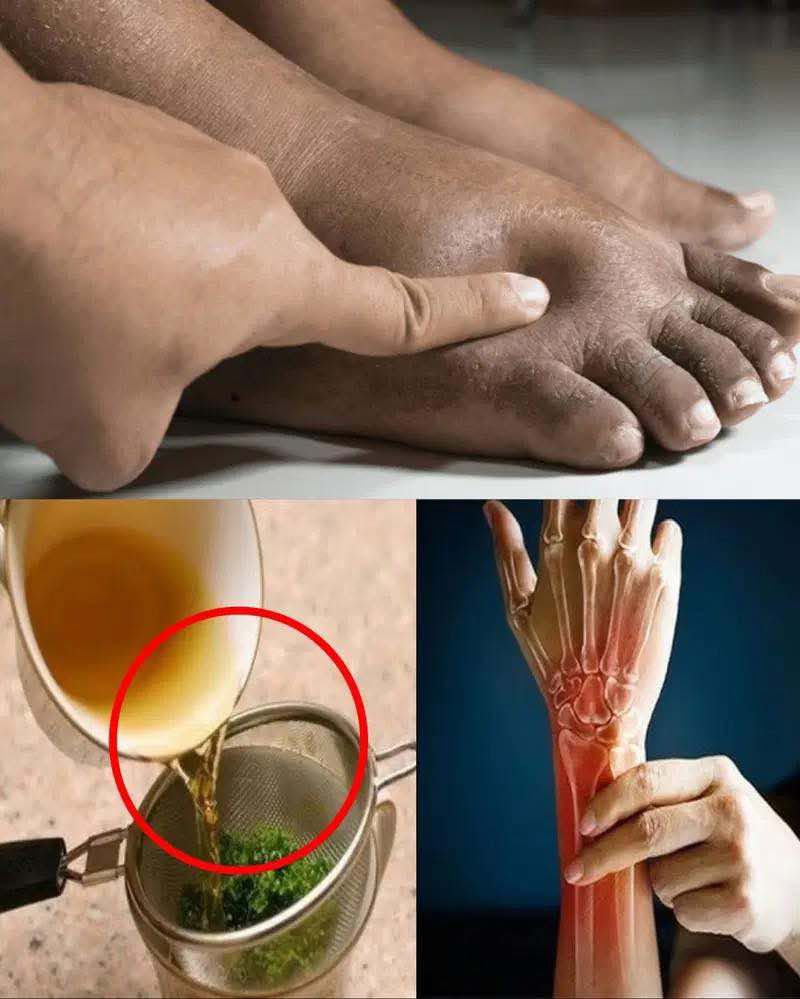 Drink this tea and say goodbye to swollen legs, ankles and feet!