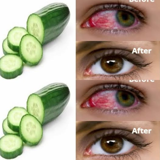 Just One Spoonful of Cucumber Elixir a Day for Sharper Vision. Here’re Your Recipe