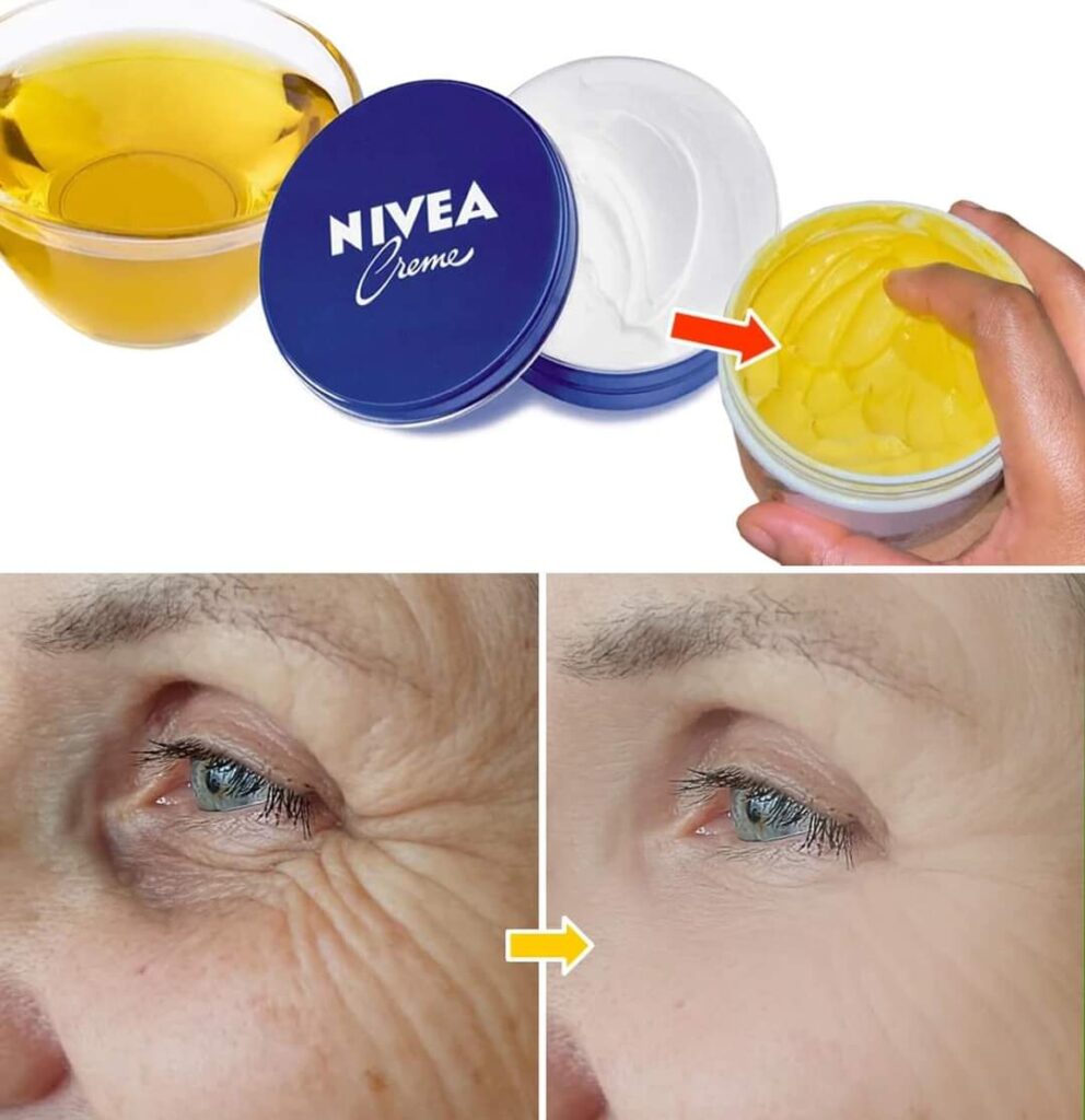 Mix Nivea cream and olive oil to make your face look 10 years younger