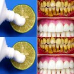 Brighten your smile naturally: The two-minute lemon whitening method