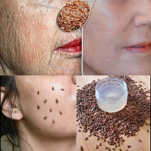 Even if you’re 70, apply it to your wrinkles: It will make your face firmer like glass! More powerful than Botox!
