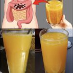 Quick recipe for colon cleansing