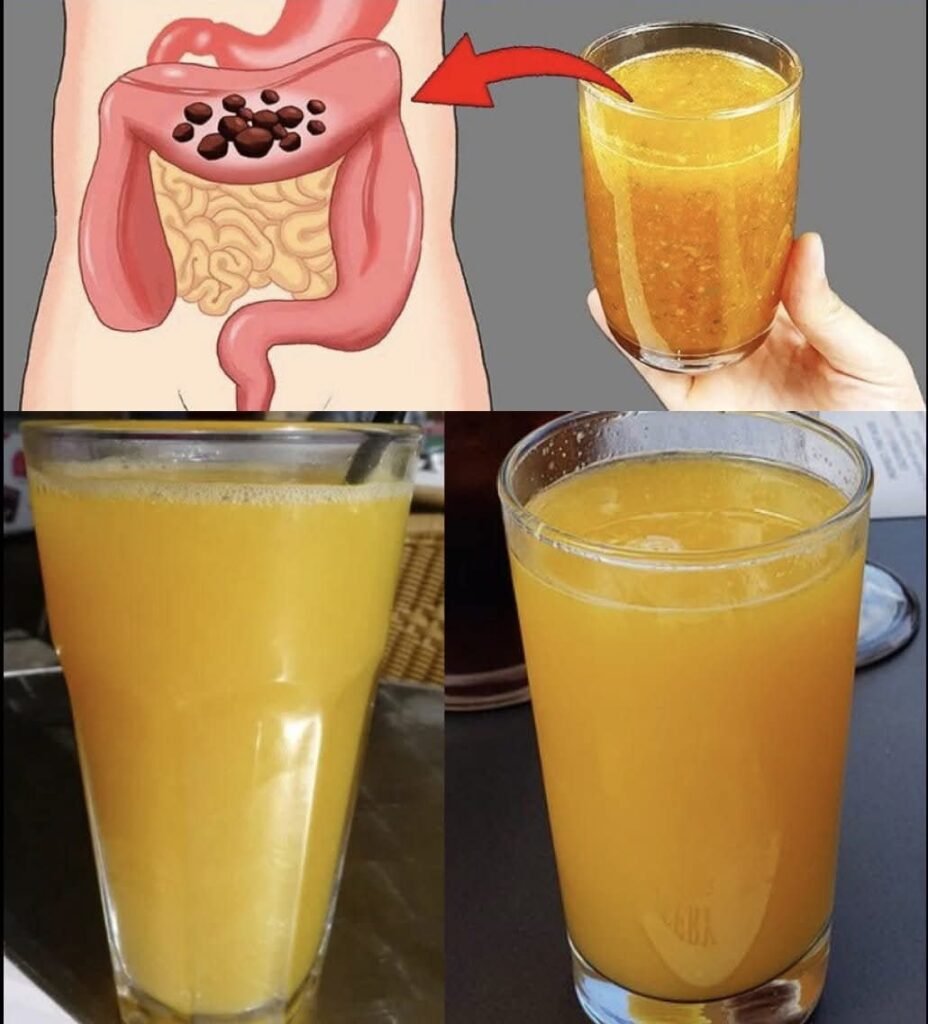 Quick recipe for colon cleansing
