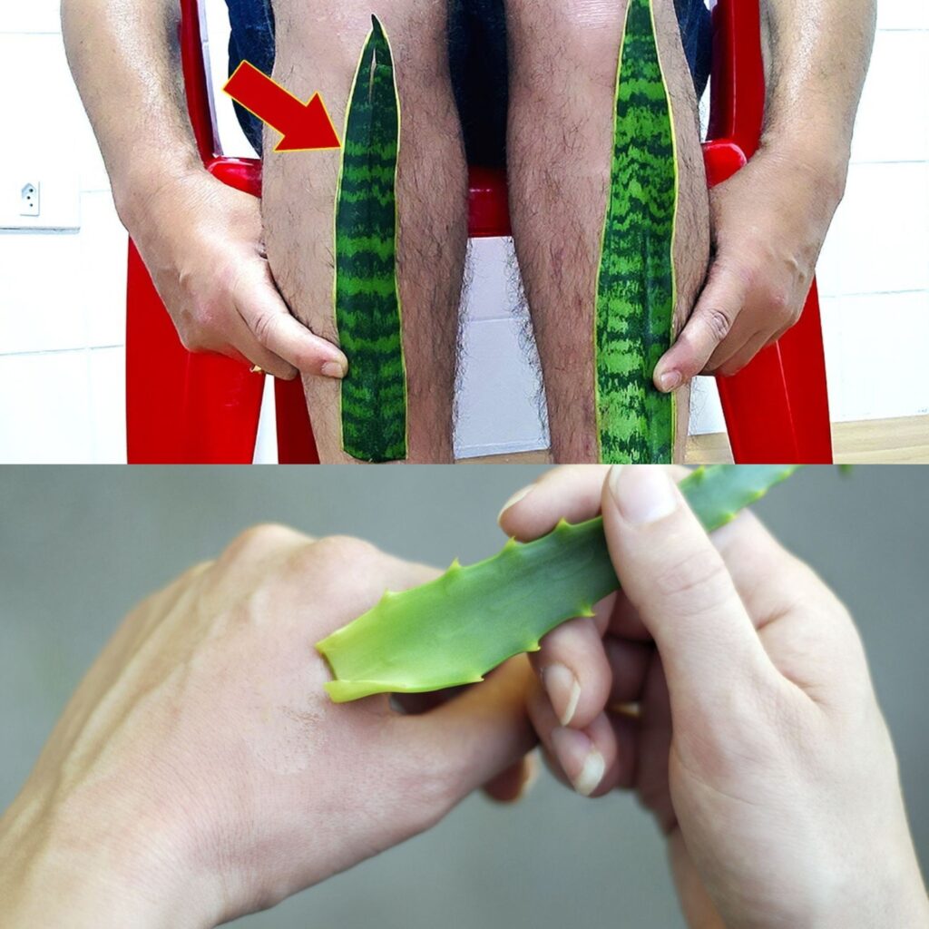 Simply apply it to your leg and stop spending money at the pharmacy – Aloe Vera! (Did you know that?)