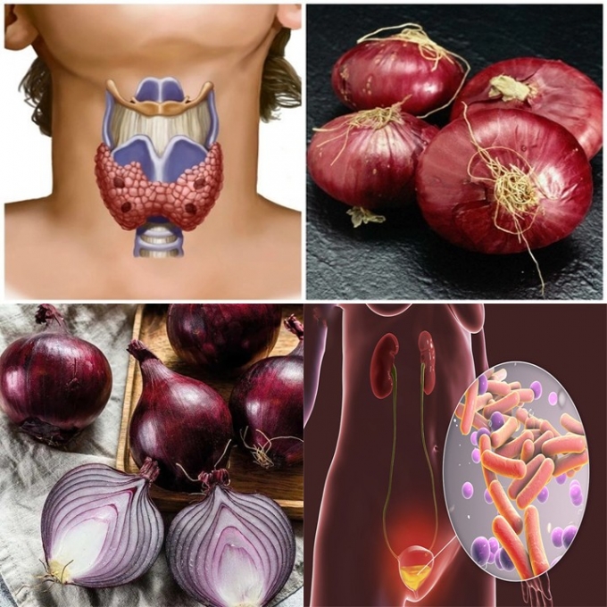 The Incredible Health Benefits of Onions (Allium cepa) for Your Bladder and Prostate