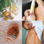 The Ultimate Housewife’s Guide to Banishing Bed Bugs for Good
