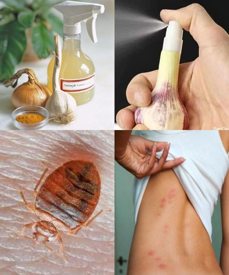 The Ultimate Housewife’s Guide to Banishing Bed Bugs for Good