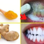 Whiten Your Teeth in Just 3 Days with This Natural Recipe