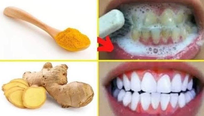 Whiten Your Teeth in Just 3 Days with This Natural Recipe