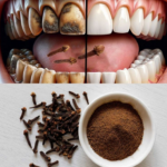 Unlock the Secret to Healthier Teeth with The Oral Care Benefits of Chewing Cloves Daily