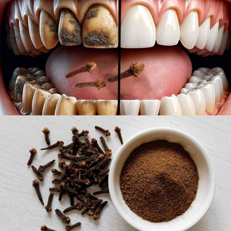 Unlock the Secret to Healthier Teeth with The Oral Care Benefits of Chewing Cloves Daily