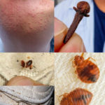 Natural Pest Control: Eliminate Bed Bugs and Household Pests with Diatomaceous Earth & Cloves