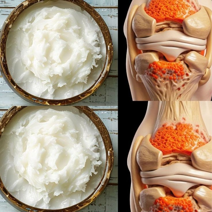 Foods to Rebuild Knee Cartilage: This Is What You Should Eat! 
