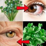 Boost Your Vision Naturally with Parsley Juice