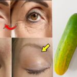 A Banana Face Mask to Reduce Wrinkles and Avoid BOTOX