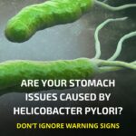 Helicobacter Pylori: The Silent Bacteria and How to Eliminate It Naturally»