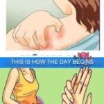 Signs of high blood sugar