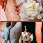 How to cure varicose veins with the help of tomatoes