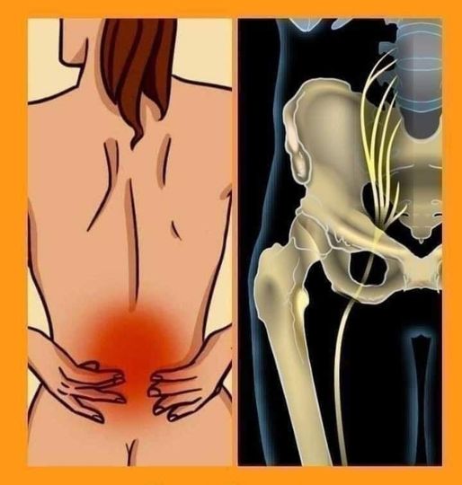 How to relieve lower back pain and sciatica with these exercises