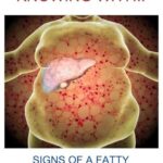 SYMPTOMS OR SIGNS THAT INDICATE THAT YOU SHOULD CLEANSE YOUR LIVER