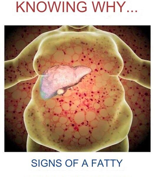 SYMPTOMS OR SIGNS THAT INDICATE THAT YOU SHOULD CLEANSE YOUR LIVER