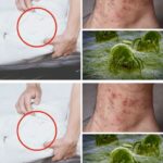 How to get rid of mites from our bed