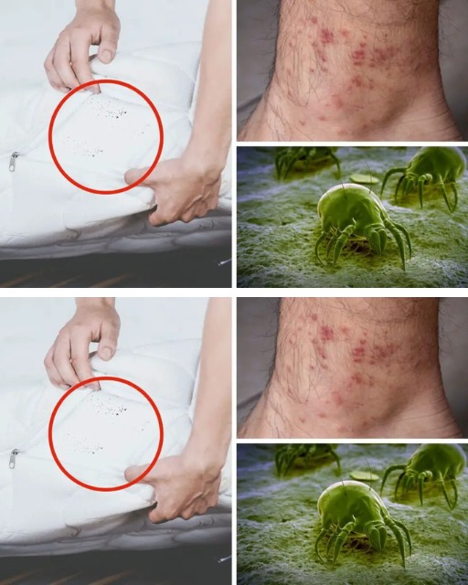 How to get rid of mites from our bed