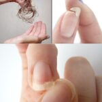 Home Remedy to Solve the Problem of Hair Loss and Brittle Nails