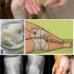For those suffering from joint and knee pain, relieving methods