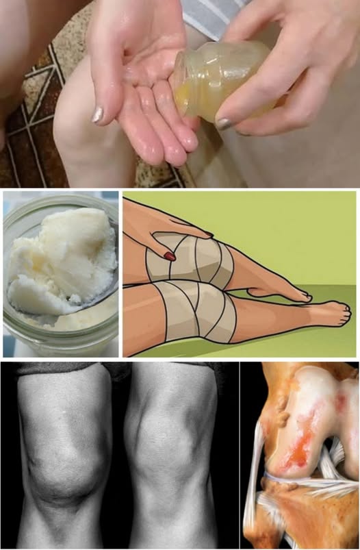 For those suffering from joint and knee pain, relieving methods