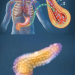 Treatment of the Pancreas Without Medication: Natural Approaches for Better Health