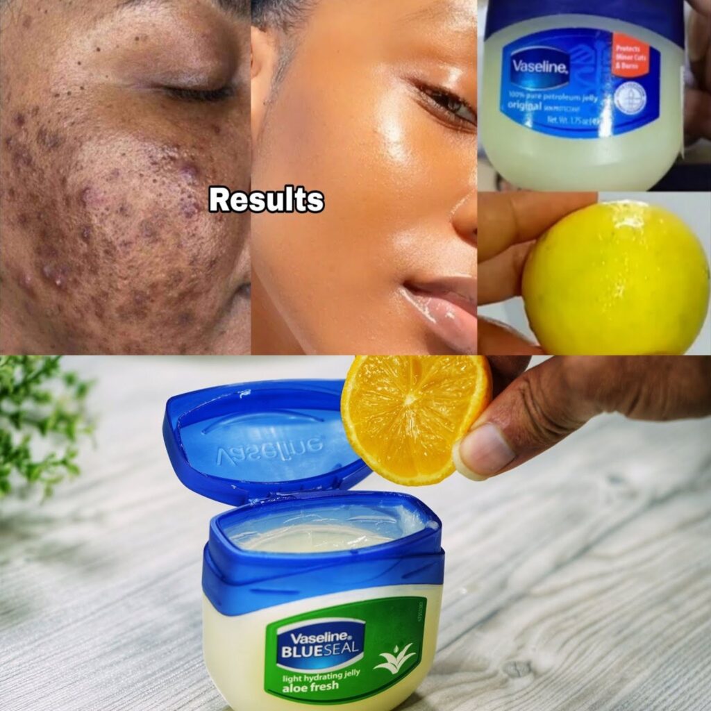 Mix Vaseline with Lemon and You’ll Be Surprised!