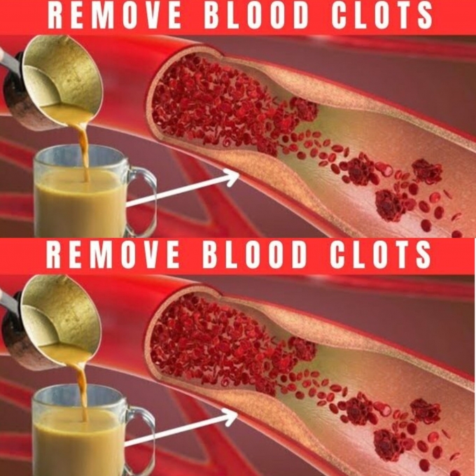 1 Cup a Day: The Powerful Turmeric and Ginger Drink for Circulatory Health