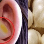 Garlic: Nature’s Super Cure
