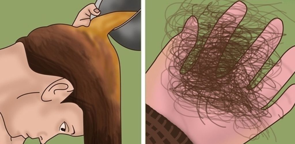 More and more people nowadays complain of excessive hair loss after having the flu or another illness.