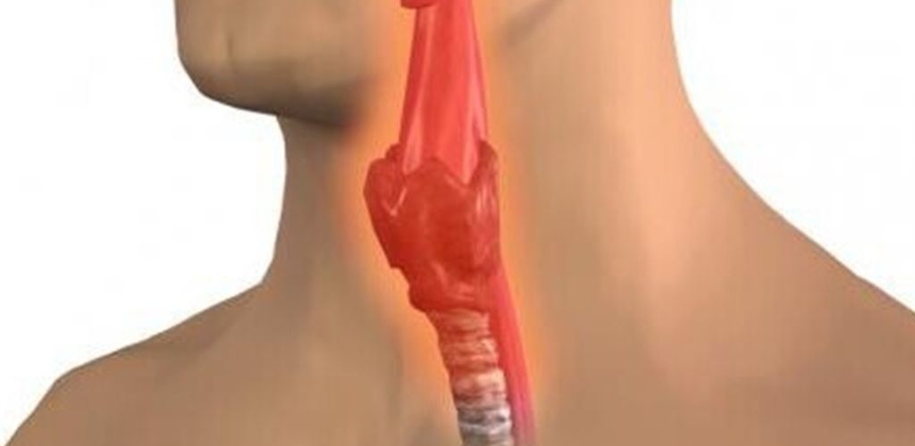 How to expel mucus from the body that sticks to the walls of the stomach and forms toxins! 