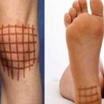 Get rid of various joint and seasonal diseases by painting with iodine on your knees, chest, back, and heels!