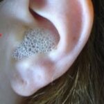 A method for clearing the ear  from blockage and dirt, you can add it immediately after the unpleasant sensation in the ear!