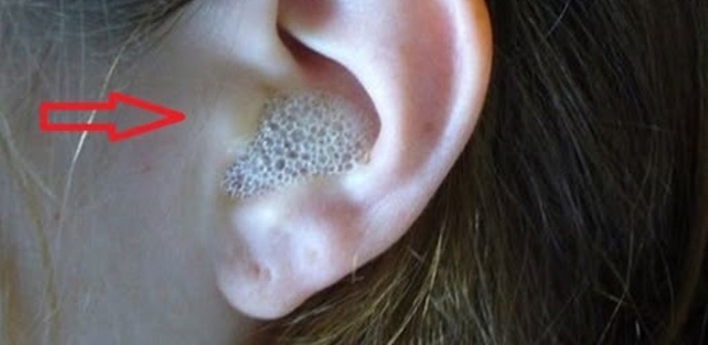 A method for clearing the ear  from blockage and dirt, you can add it immediately after the unpleasant sensation in the ear!