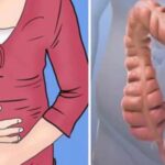 Lazy intestines are death to the body – see how you can cleanse them of all poisons: