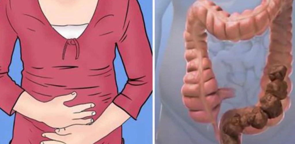 Lazy intestines are death to the body – see how you can cleanse them of all poisons: