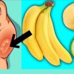 This is something everyone who has joint and bone pain should know!The best foods that will help you against joint and bone pain really effectively!